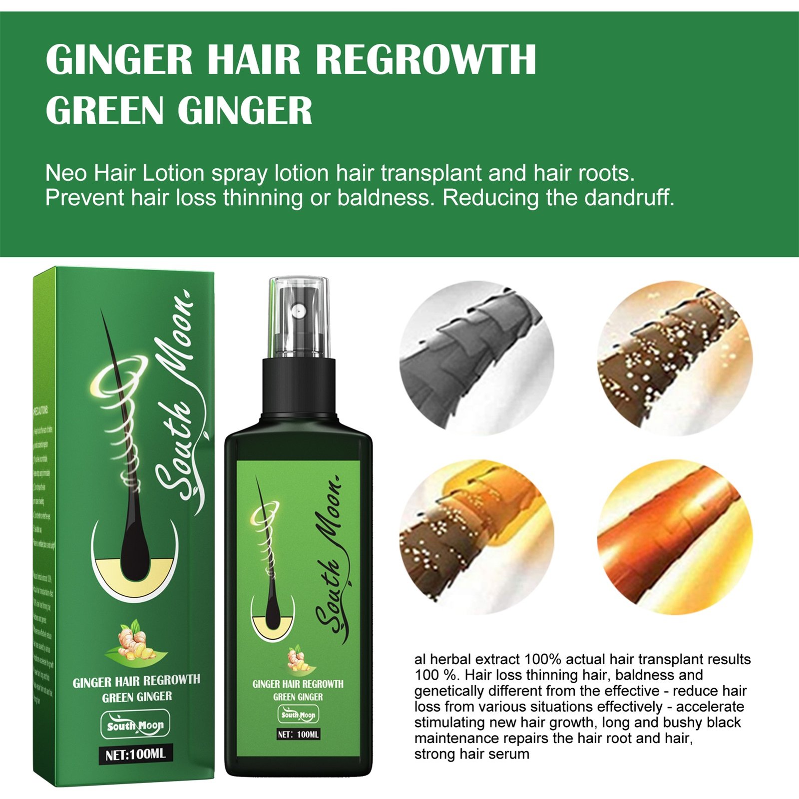100ml-Hair-Growth-Serum-Hair-Lotion-Anti-Hair-Loss-Herbal-HairReBirth-Essence-Spra-Y-Serum-Ginger-1-1.jpg