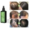 100ml-Hair-Growth-Serum-Hair-Lotion-Anti-Hair-Loss-Herbal-HairReBirth-Essence-Spra-Y-Serum-Ginger-4-1.jpg