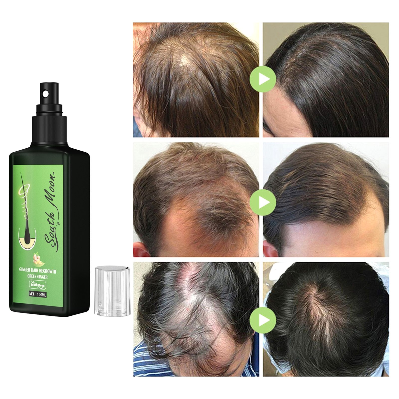100ml-Hair-Growth-Serum-Hair-Lotion-Anti-Hair-Loss-Herbal-HairReBirth-Essence-Spra-Y-Serum-Ginger-4-1.jpg